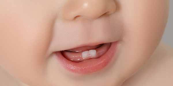 bambino neonato sorriso pedodonzia studio dentistico fausto fiorile